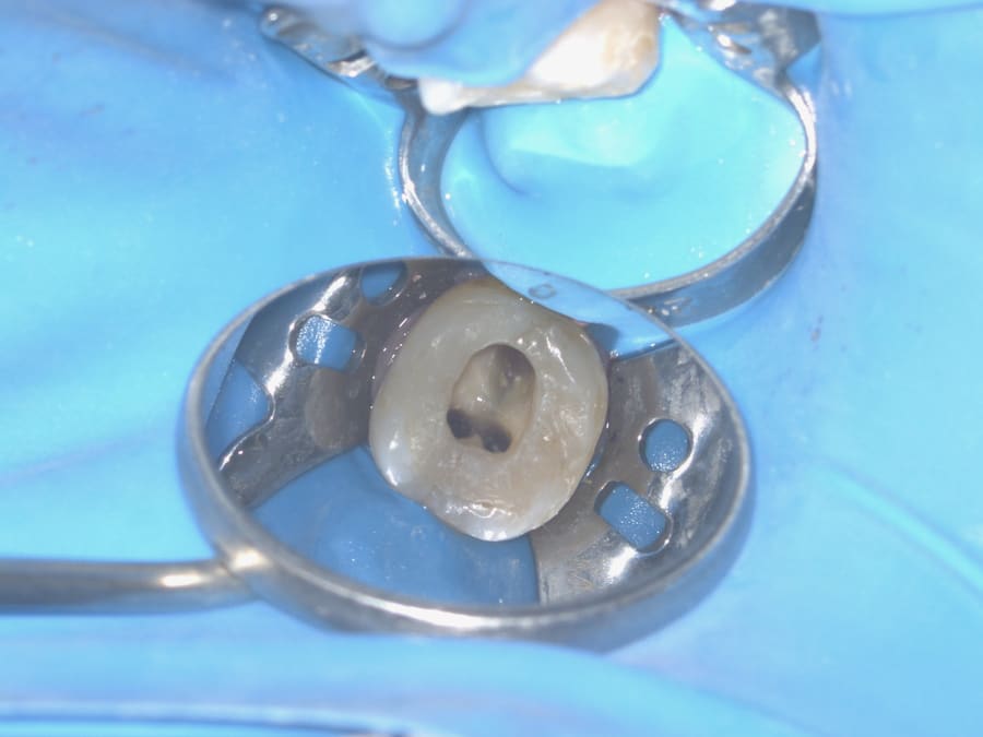 Microscopia · câmara pulpar