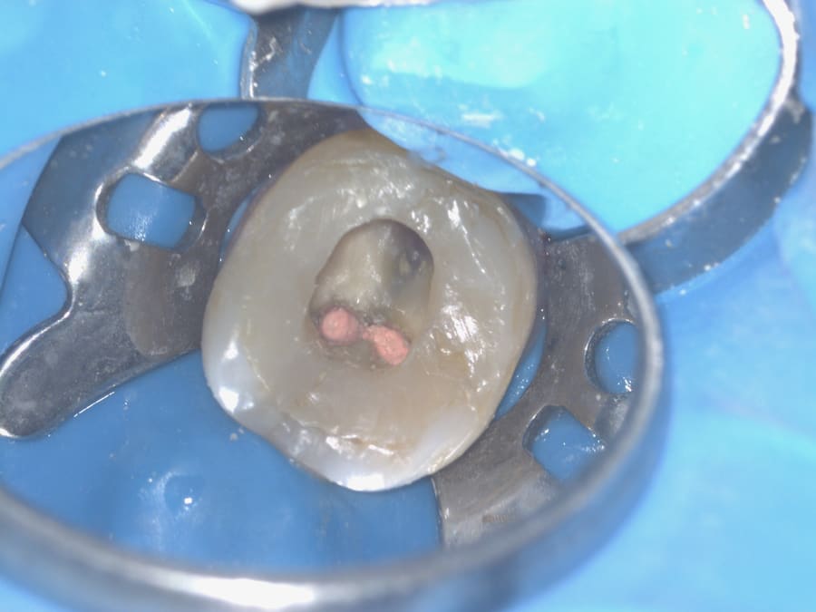 Microscopia · obturação dos condutos