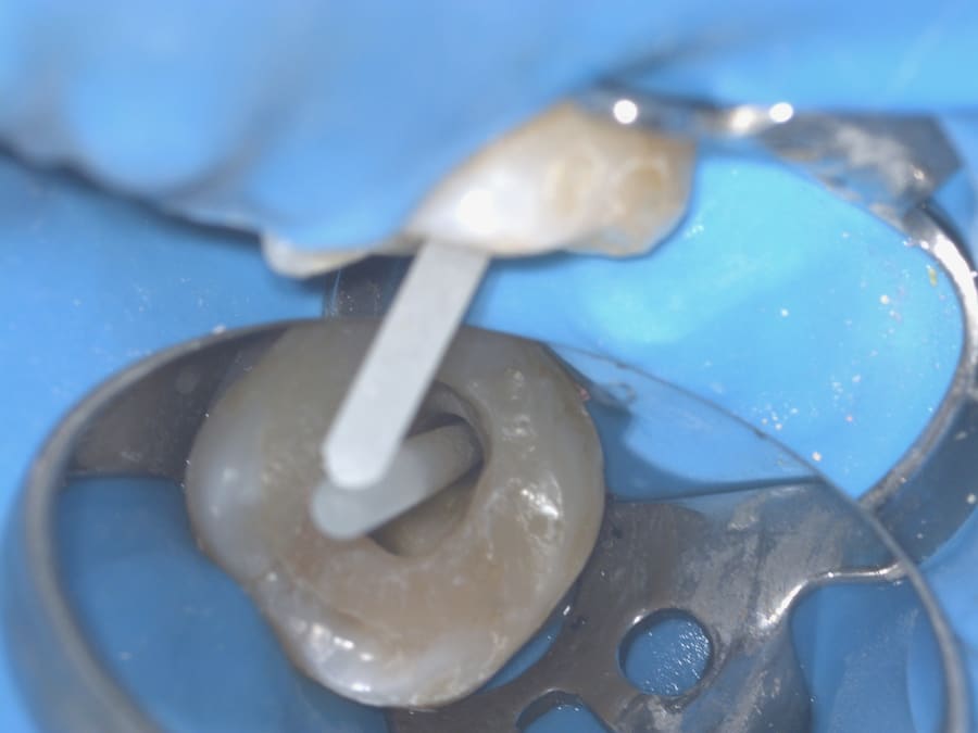 Microscopia · prova do pino de fibra